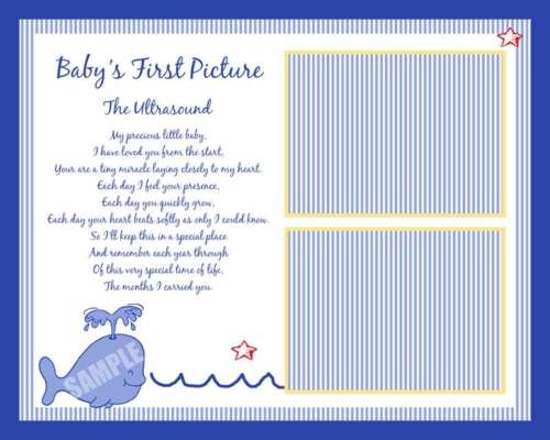 WHALES Baby Ultrasound Photo Print Scrapbook Wall Decor  